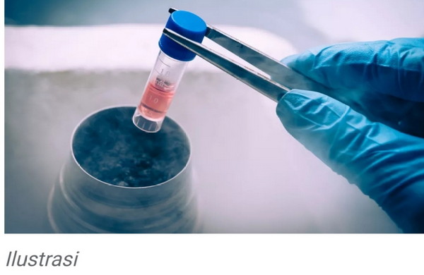 Hadir di Indonesia, Ayo Kenali Manfaat Terapi Stem Cell